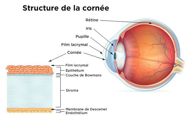 Originale, Rougeur oculaire